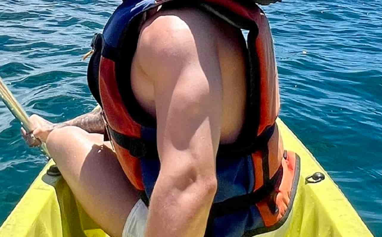 Triceps